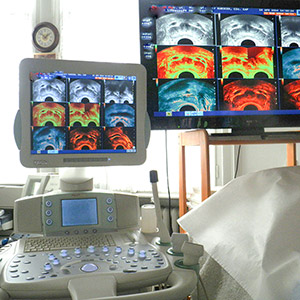 ultrasonografie prostaty s harmonickm zobrazenm