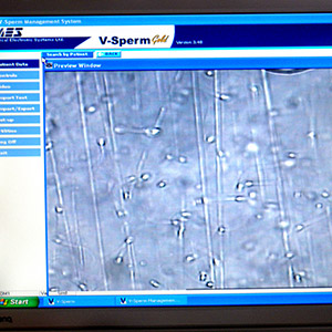 videomikroskopie spermatu